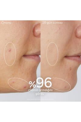 Arındırıcı Temizleme Jeli 75 ml - 4