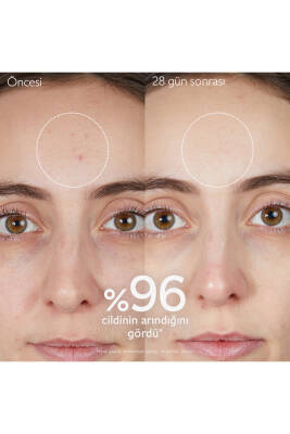 Arındırıcı Temizleme Jeli 75 ml - 5