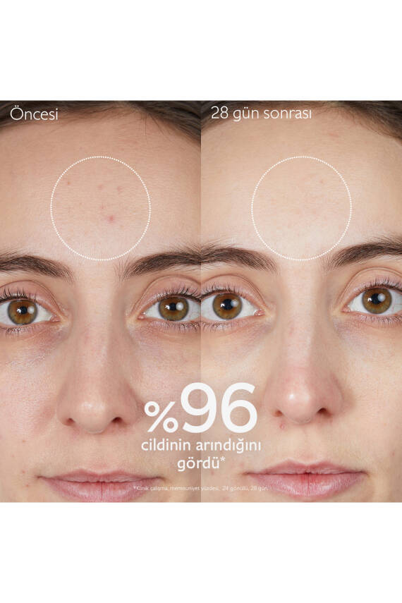 Arındırıcı Temizleme Jeli 75 ml - 5