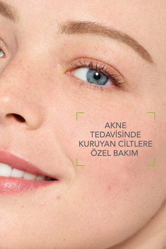Bioderma Sebium Hydra Yoğun Nemlendirici Seramid Içeren Yatıştırıcı Bakım Kremi 40 ml - 2