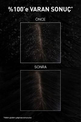 Bioxcin Aqua Thermal Kepek Karşıtı Şampuan 300 ml 2 Adet - Kaşıntı Ve Kepek Önleyici - 7