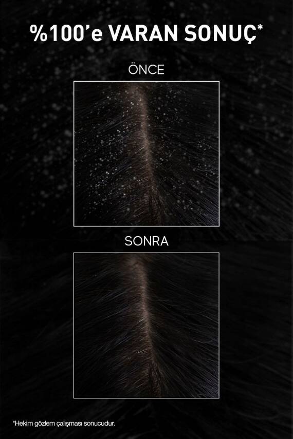 Bioxcin Aqua Thermal Kepek Karşıtı Şampuan 300 ml 2 Adet - Kaşıntı Ve Kepek Önleyici - 7