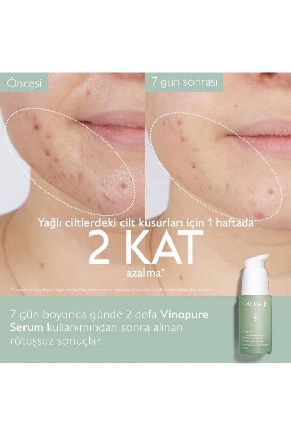 Caudalie Vinopure Salisilik Serum 30 ml - 3