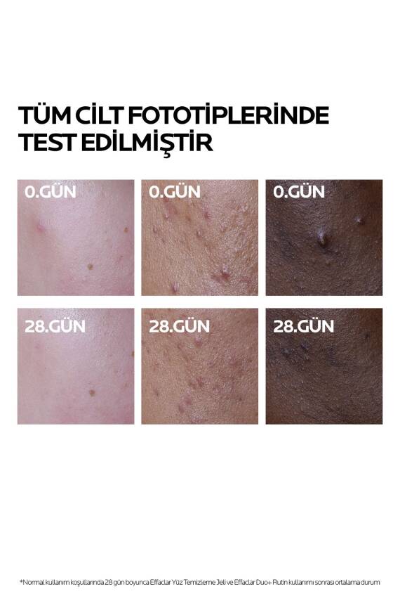 La Roche Posay Effaclar Duo+M Yağlı, Akne/Sivilce Eğilimli Ciltler için Bakım Kremi 40ml - 3