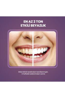 Splat Wonder White Incir Özlü Diş Macunu 75 ml - 3