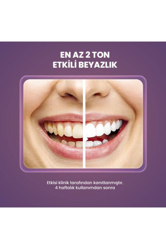 Splat Wonder White Incir Özlü Diş Macunu 75 ml - 3