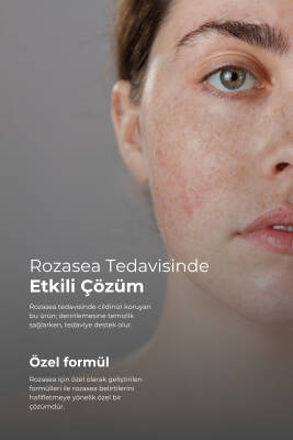 Tto Akne-Rozasea Bakım Seti - 4