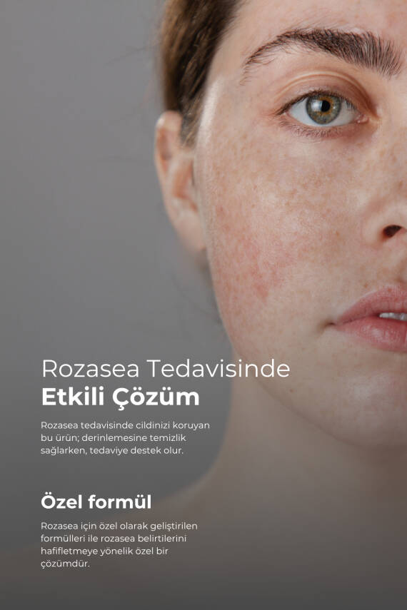 Tto Akne-Rozasea Bakım Seti - 4