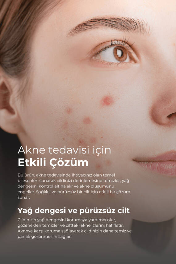 Tto Akne ve Rozasea Bakım Seti Temizleme Jeli Dermodicos Plus - 2