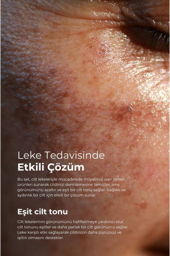 Tto Clinic Leke Kremi 75ml - 4