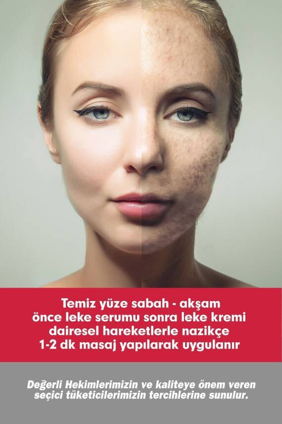Tto CLINIC LEKE KREMİ 75ML + LEKE SERUMU 50ML - 5