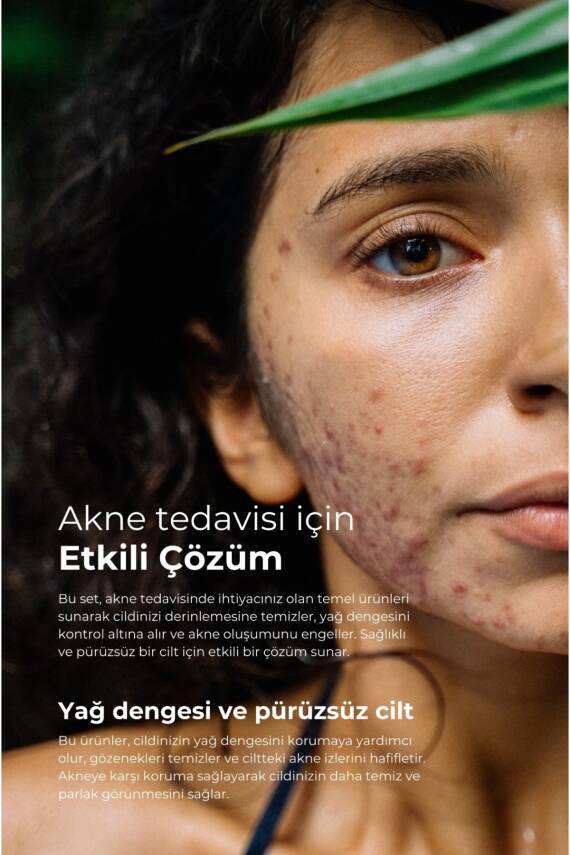 Tto Kil Maskesi 12’li Sivilce Ve Siyah Nokta Karşıtı Yüz Maskesi( Çay Ağacı Yağı / Tea Tree Oil ) - 4