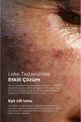 Tto Leke Bakım Seti - 7