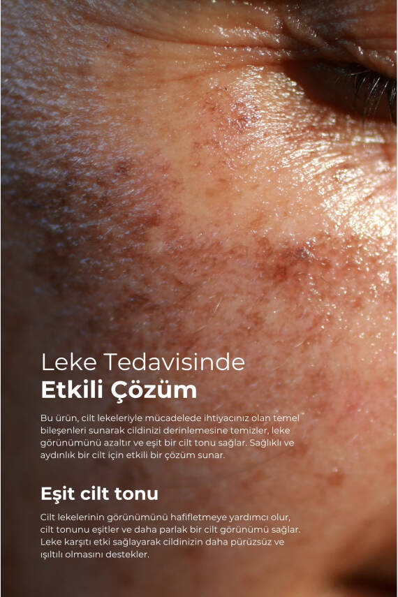 Tto Leke Bakım Seti - 7