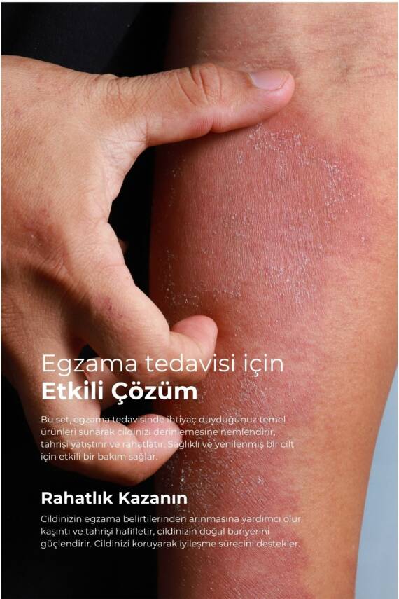 Tto Sıvı Sabun 250 ml Egzamalı, Mantarlı, Atopik Ciltler İçin - 3