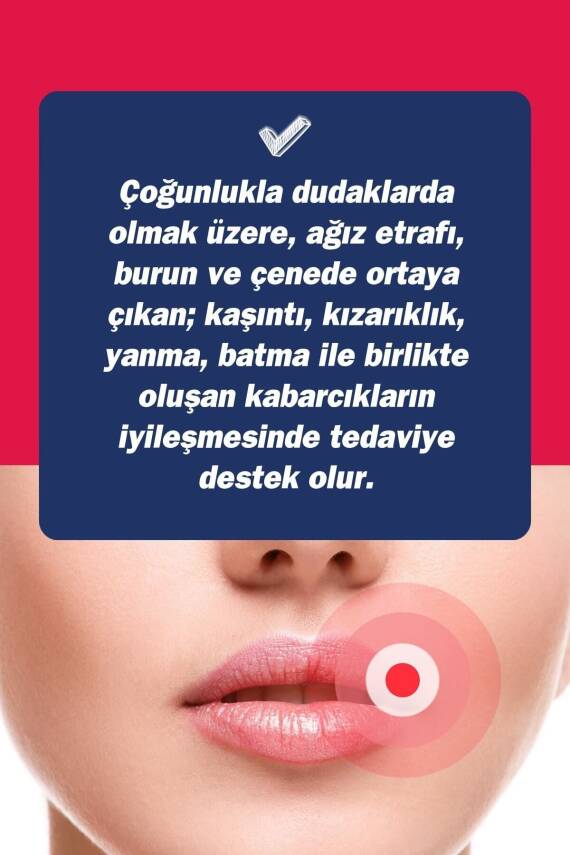Tto Ux Uçuk Kremi 10ml - 2