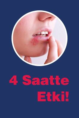 Tto Ux Uçuk Kremi 10ml - 3