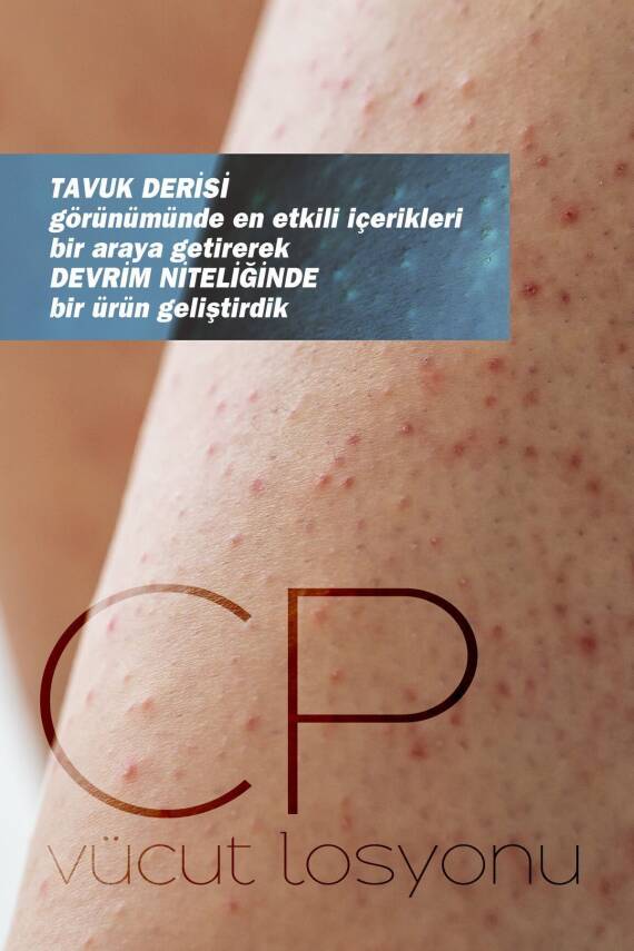 Tto Cp Vücut Losyonu 200ml - 2