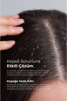 Tto X Kepekli ve Yağlı Saçlara Özel Şampuan Kolajen ve Prebiyotik 500ml - 2