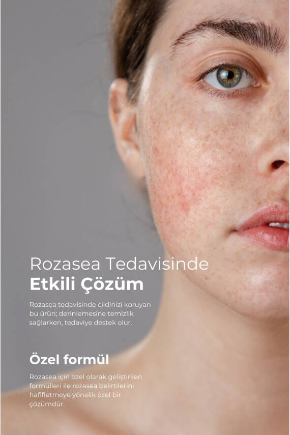 Tto Yüz Temizleme Köpüğü 200 ml - 6