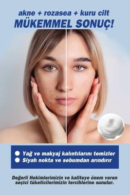 Tto Yüz Temizleme Köpüğü 2'li (aplikatörlü Ve Aplikatörsüz) (çay Ağacı Yağı / Tea Tree Oıl) - 3