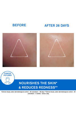 Uriage Xemose Creme Visage Atopik Ve Çok Kuru Ciltler Için Yatıştırıcı Yüz Kremi 40 ml - 7