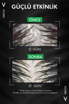 Vichy Dercos Hassas Saç Kepek Karşıtı Şampuan 200ml - 4